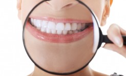 あの美容習慣も一因に!?｢歯の黄ばみ｣の原因＆予防法