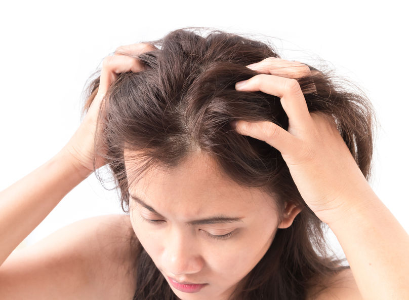 71537862 - closeup woman hand itchy scalp, hair care concept