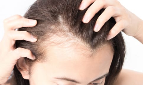 ヘアケアは内側から!?「薄毛」に良い注目の栄養素とは？