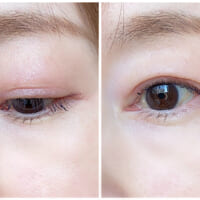 シミが目立ちやすくなった理由は？ 40・50代のための“効かせる”美白ケア