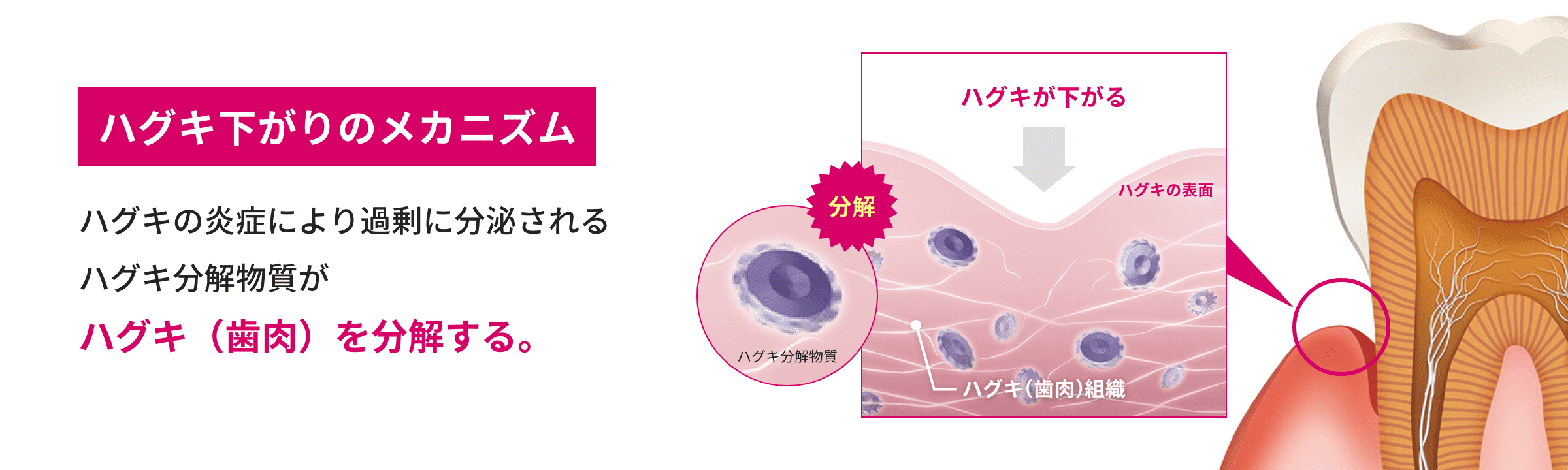 老け見えの原因は口元!?40・50代がすべきハグキケアとは