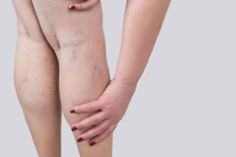 足だけ痩せない理由は？原因や改善のためのケア方法を解説