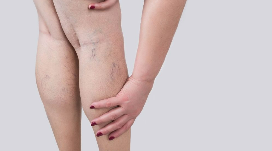 足だけ痩せない理由は？原因や改善のためのケア方法を解説