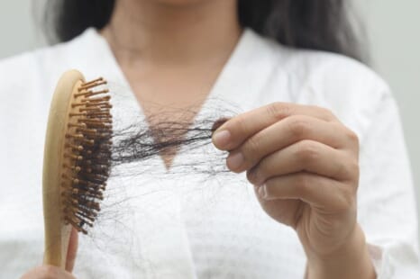 女性の抜け毛の原因は？主な原因と対策・予防方法を解説