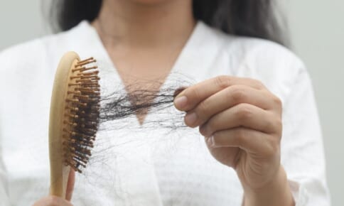 女性の抜け毛の原因は？主な原因と対策・予防方法を解説