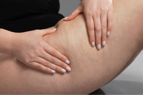 セルライトはなぜ痛い？痛みの原因や軽減する方法と注意点を解説