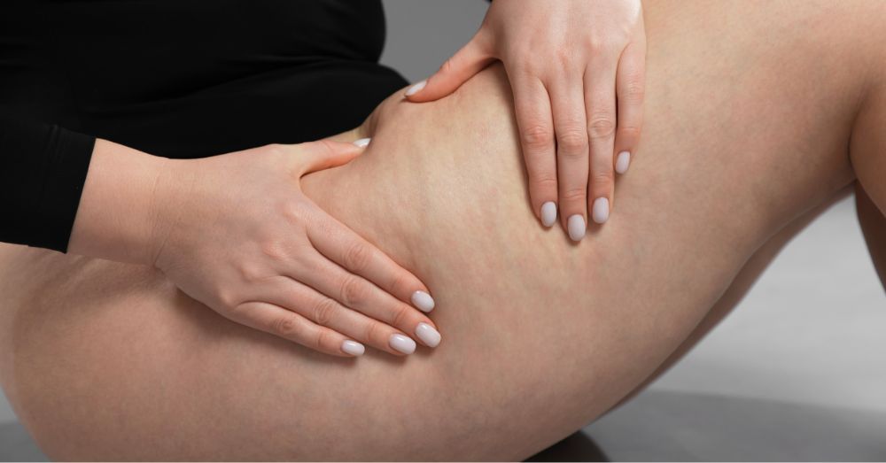 セルライトはなぜ痛い？痛みの原因や軽減する方法と注意点を解説