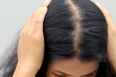 髪のボリュームがなくなる理由！主な原因と対策・対処法を解説