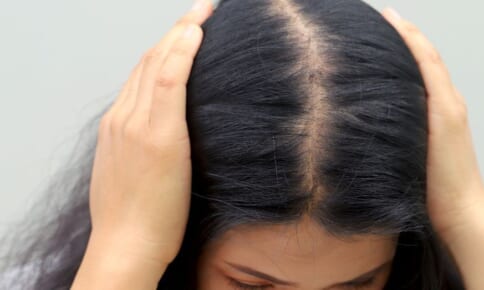 髪のボリュームがなくなる理由！主な原因と対策・対処法を解説