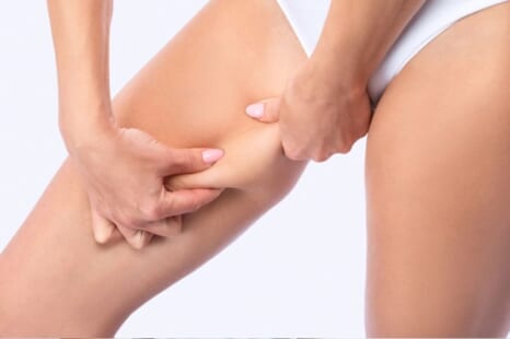 太ももが痩せない原因は？主な理由・パターン別の特徴・対策を解説