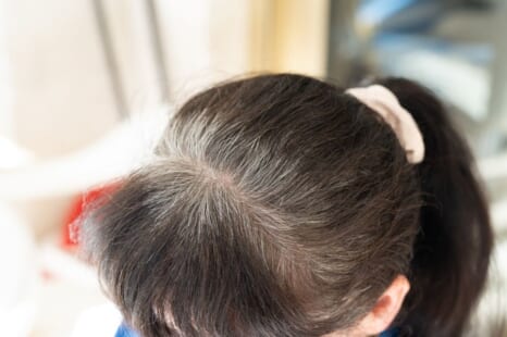 白髪が増える原因は？年代別の要因や対策・予防法を解説