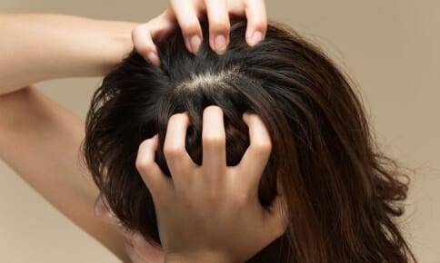 頭のかゆみを抑えるには？かゆみを引き起こす原因と対策