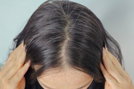 白髪を黒髪に戻す方法は？ケア方法やNGな習慣を解説