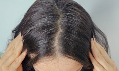 白髪を黒髪に戻す方法は？ケア方法やNGな習慣を解説