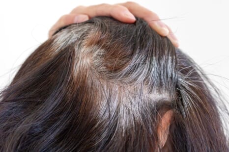 白髪の対策はどうしたらいい？白髪の対処法や注意点を解説