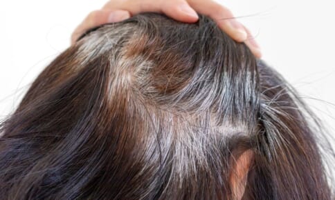 白髪の対策はどうしたらいい？白髪の対処法や注意点を解説