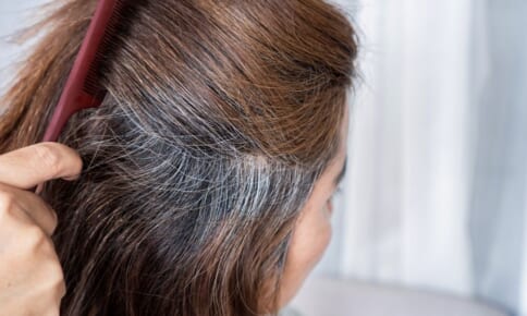 ダイエットをサポート！夏こそ食べたいフルーツ4つ