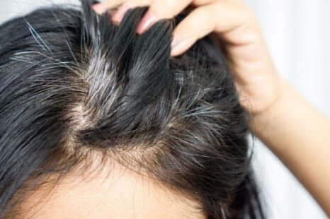 40代の女性の白髪対策は？白髪が増える原因や対処法を解説