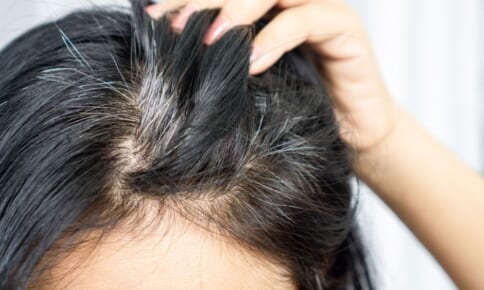 ダイエットをサポート！夏こそ食べたいフルーツ4つ