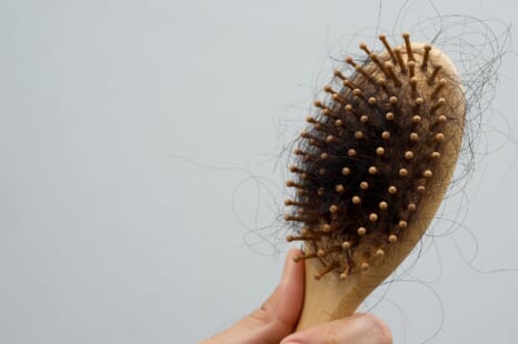 更年期は抜け毛が増える？対策は？原因やおすすめの治療方法を解説