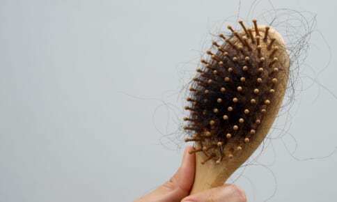更年期は抜け毛が増える？対策は？原因やおすすめの治療方法を解説