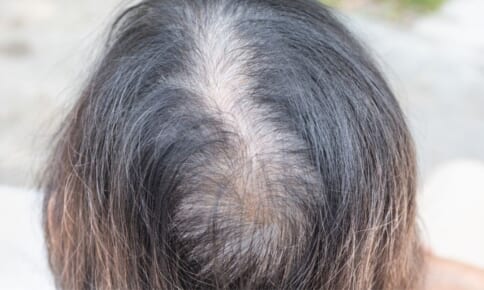 若々しい胸元に！40・50代が今すぐすべきバストケア