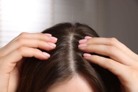 分け目が目立つ女性の対策は？原因やパターン別の対処方法を解説
