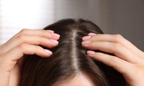 分け目が目立つ女性の対策は？原因やパターン別の対処方法を解説