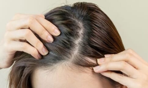 夕方になると髪がベタつく？原因や対策・予防方法を解説