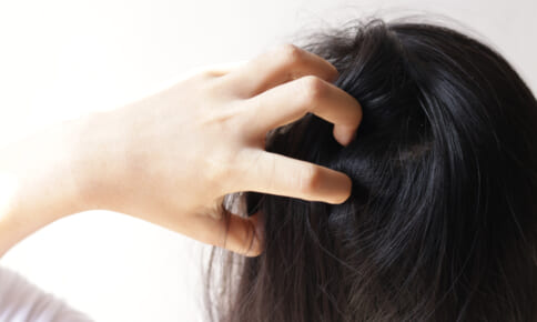 白髪染めのかゆみの原因は？頭皮がかゆくなる人の特徴や対策を解説