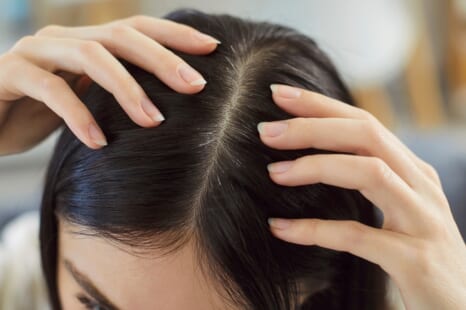 頭皮ケアの正しいやり方は？自宅でできる方法やおすすめグッズを紹介